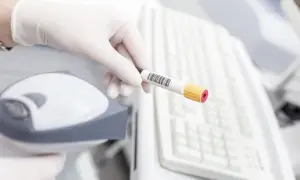 Rękawiczka z probówką krwi, przygotowana do analizy. Wyniki badań pomogą ustalić kryteria rozpoznania cukrzycy.