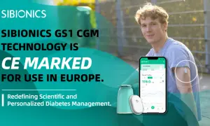 Młody mężczyzna z czujnikiem SIBIONICS GS1 na ramieniu, prezentujący technologię CGM. Aplikacja na telefonie pokazuje dane o glukozie.