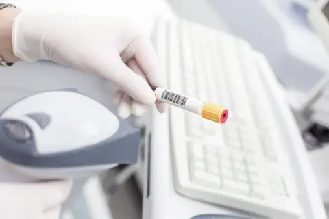 Rękawiczka z probówką krwi, przygotowana do analizy. Wyniki badań pomogą ustalić kryteria rozpoznania cukrzycy.
