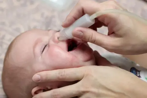 Delikatne odciąganie kataru u niemowlaka za pomocą aspiratora. Dziecko ma otwarte usta, a rodzic ostrożnie wprowadza końcówkę urządzenia do noska.