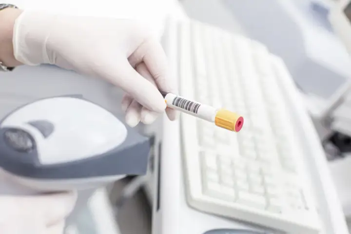 Rękawiczka z probówką krwi, przygotowana do analizy. Wyniki badań pomogą ustalić kryteria rozpoznania cukrzycy.